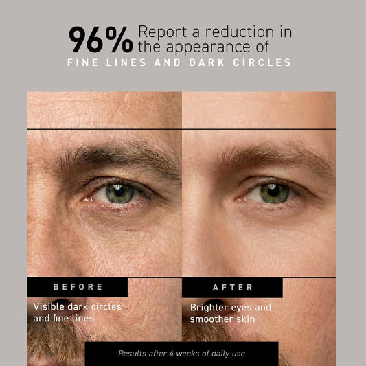 Brickell Men's Restoring Under Eye Cream for Men, Natural and Organic Anti Aging Eye Balm To Reduce Puffiness, Wrinkles, Dark Circles, Crows Feet and Under Eye Bags, 0.5 Ounce, Unscented