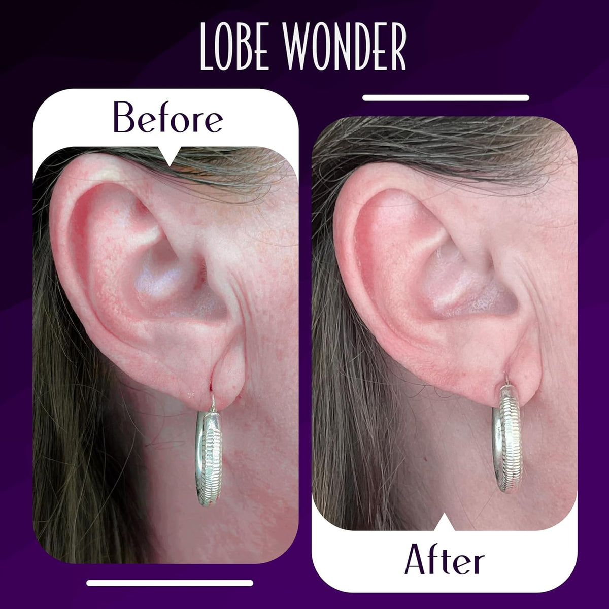 Lobe Wonder - The ORIGINAL Ear Lobe Support Patch for Pierced Ears - Eliminates the Look of Torn or Stretched Piercings - Protects Healthy Ear Lobes from Tearing - 60 Patches - Clear & Latex-Free
