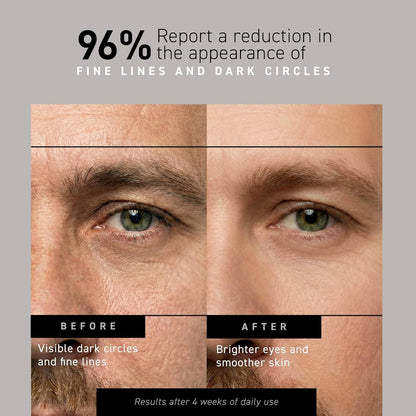 Brickell Men's Restoring Under Eye Cream for Men, Natural and Organic Anti Aging Eye Balm To Reduce Puffiness, Wrinkles, Dark Circles, Crows Feet and Under Eye Bags, 0.5 Ounce, Unscented