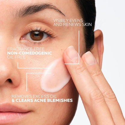 La Roche-Posay Effaclar Dual Acne Face Wash With 4% Benzoyl Peroxide & LHA Exfoliant, Acne Treatment Help Clear & Prevent Blemishes, Paraben Free & Oil Free Wash, 6.76 Fl Oz